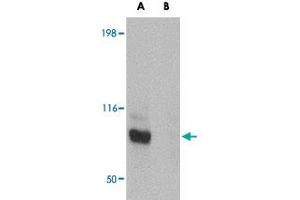 Western blot analysis of JPH3 in Daudi cell lysate with JPH3 polyclonal antibody  at 1 ug/mL in (A) the absence and (B) the presence of blocking peptide. (Junctophilin 3 Antikörper  (C-Term))