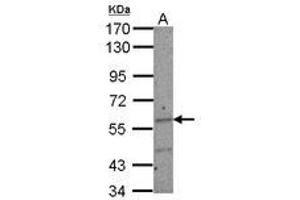 Image no. 2 for anti-IKAROS Family Zinc Finger 2 (IKZF2) (AA 263-504) antibody (ABIN1498849) (IKZF2 Antikörper  (AA 263-504))