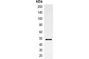Immunoprecipitation of AmCyan-tagged protein from HEK293T cells transfected with vector overexpressing AmCyan tag, using Anti-AmCyan-tag Antibody. (AmCyan Antikörper)