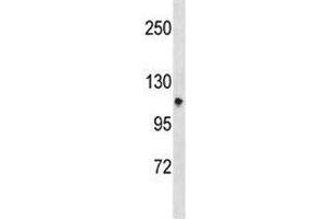 Integrin alpha 7 antibody western blot analysis in CEM lysate. (ITGA7 Antikörper  (AA 229-257))