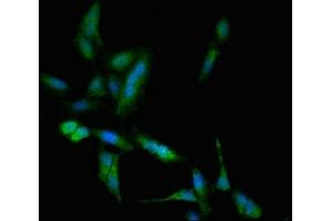 Immunofluorescent analysis of Hela cells using ABIN7171654 at dilution of 1:100 and Alexa Fluor 488-congugated AffiniPure Goat Anti-Rabbit IgG(H+L) (TBC1D4 Antikörper  (AA 1-94))
