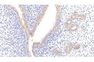 Detection of CTTN in Rat Uterus Tissue using Polyclonal Antibody to Cortactin (CTTN) (Cortactin Antikörper  (AA 1-509))