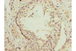 Immunohistochemistry of paraffin-embedded human testis tissue using ABIN7166731 at dilution of 1:100 (NSUN7 Antikörper  (AA 1-300))