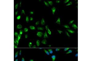 Immunofluorescence analysis of HeLa cells using RASSF1 Polyclonal Antibody (RASSF1 Antikörper)