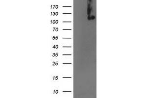 Western Blotting (WB) image for anti-Excision Repair Cross-Complementing Rodent Repair Deficiency, Complementation Group 4 (ERCC4) antibody (ABIN1498073) (ERCC4 Antikörper)