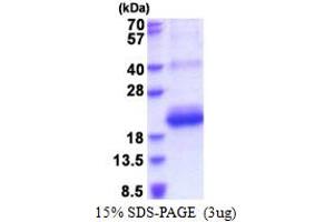 SDS-PAGE (SDS) image for CD164 Sialomucin-Like 2 (CD164L2) (AA 30-141) protein (His tag) (ABIN5853585)