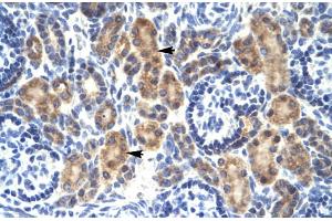 Rabbit Anti-MYCBP Antibody Catalog Number: ARP31860 Paraffin Embedded Tissue: Human Kidney Cellular Data: Epithelial cells of renal tubule Antibody Concentration: 4. (MYCBP Antikörper  (Middle Region))