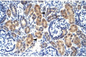 Rabbit Anti-MYCBP Antibody Catalog Number: ARP31860 Paraffin Embedded Tissue: Human Kidney Cellular Data: Epithelial cells of renal tubule Antibody Concentration: 4. (MYCBP Antikörper  (Middle Region))
