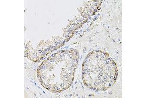Immunohistochemistry of paraffin-embedded human prostate using CIB1 antibody (ABIN1871861) at dilution of 1:100 (40x lens). (CIB1 Antikörper)