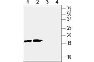 Western blot analysis of mouse (lanes 1 and 3) and rat (lanes 2 and 4) brain lysates: - 1,2. (beta Synuclein Antikörper  (C-Term, Intracellular))