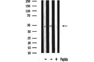 anti-Transcriptional Adaptor 2A (TADA2A) (Internal Region) antibody