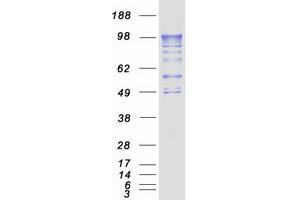 PDE4A Protein (Transcript Variant 4) (Myc-DYKDDDDK Tag)