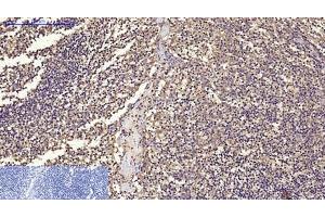 Immunohistochemistry of paraffin-embedded Human tonsil tissue using CD68 Monoclonal Antibody at dilution of 1:200. (CD68 Antikörper)