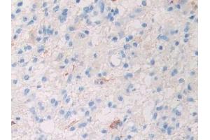 Immunohistochemistry (IHC) image for anti-Slit Homolog 1 (SLIT1) (AA 647-835) antibody (ABIN7438364)