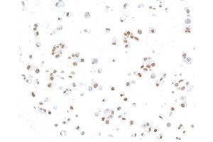Immunocytochemistry (ICC) image for anti-ThPok (AA 250-300) antibody (ABIN7455169) (Rekombinanter ThPok (AA 250-300) Antikörper)