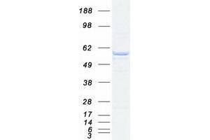 PPP2R5B Protein (Myc-DYKDDDDK Tag)