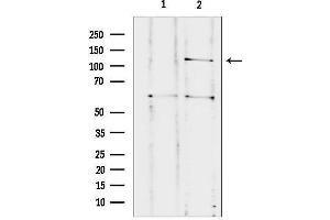 Western blot analysis of lysates from HUVEC, using CNTNAP3 Antibody.