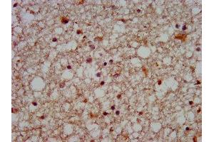 IHC image of ABIN7170083 diluted at 1:500 and staining in paraffin-embedded human brain tissue performed on a Leica BondTM system. (KCC2 Antikörper  (AA 944-1071))