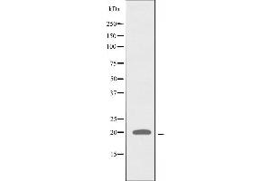 Western blot analysis of extracts from COLO cells, using RPL27A antibody. (RPL27A Antikörper  (C-Term))