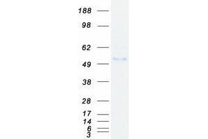 Western Blotting (WB) image for Cbl proto-oncogene C (CBLC) (Transcript Variant 1) protein (Myc-DYKDDDDK Tag) (ABIN2713256)