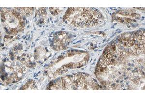 ABIN6277530 at 1/100 staining Human prostate tissue by IHC-P. (Golgin A2 (GOLGA2) (N-Term) Antikörper)