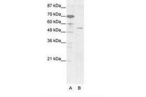 Image no. 1 for anti-Homeobox even-skipped homolog protein 2 (EVX2) (AA 63-112) antibody (ABIN203247) (EVX2 Antikörper  (AA 63-112))