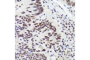 Immunohistochemistry of paraffin-embedded human colon carcinoma using RNF40 Rabbit mAb (ABIN7270074) at dilution of 1:100 (40x lens). (RNF40 Antikörper)