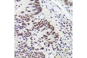 Immunohistochemistry of paraffin-embedded human colon carcinoma using RNF40 Rabbit mAb (ABIN7270074) at dilution of 1:100 (40x lens).