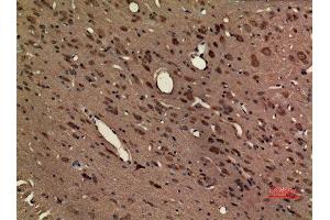 Immunohistochemistry (IHC) analysis of paraffin-embedded Rat Brain, antibody was diluted at 1:100. (CX3CR1 Antikörper  (Internal Region))