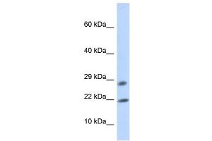 OCIAD2 antibody used at 1 ug/ml to detect target protein. (OCIAD2 Antikörper  (Middle Region))