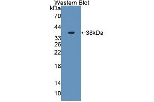Detection of Recombinant PLSCR4, Human using Polyclonal Antibody to Phospholipid Scramblase 4 (PLSCR4) (PLSCR4 Antikörper  (AA 1-303))