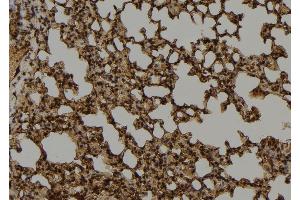 ABIN6276763 at 1/100 staining Mouse lung tissue by IHC-P.