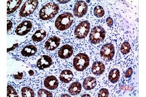 Immunohistochemistry (IHC) analysis of paraffin-embedded Human Colon, antibody was diluted at 1:100. (KRT8 Antikörper  (Ser726, Ser731))