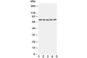 Western blot testing of ABCG1 antibody and Lane 1:  U87;  2: SMMC-7721;  3: HeLa;  4: COLO320;  5: MCF-7 cell lysate.