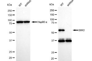 Western blotting analysis using S6K2 antibody (ABIN7800227). (Rekombinanter RPS6KB2 Antikörper)