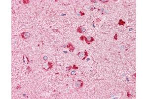 Anti-RIF1 antibody IHC of human brain, cortex. (RIF1 Antikörper  (AA 2076-2089))