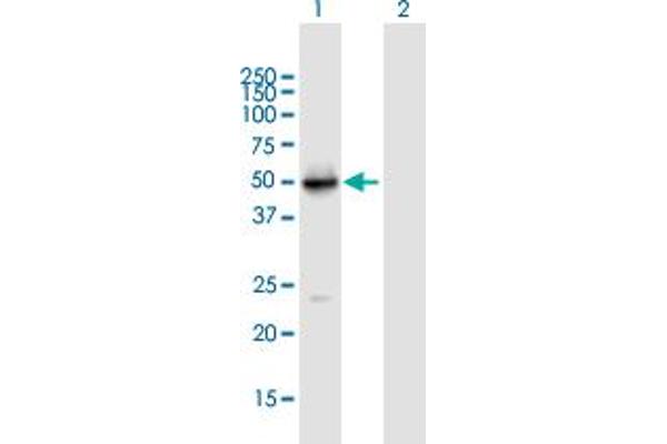 Vitamin D Receptor Antikörper  (AA 1-427)