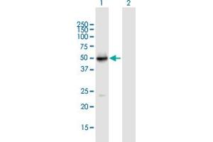 Western Blot analysis of VDR expression in transfected 293T cell line by VDR MaxPab polyclonal antibody.