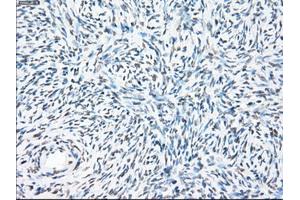 Immunohistochemical staining of paraffin-embedded colon tissue using anti-PPP5Cmouse monoclonal antibody. (PP5 Antikörper)