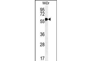 TANK Antibody (Center) (ABIN652041 and ABIN2840515) western blot analysis in WiDr cell line lysates (35 μg/lane). (TANK Antikörper  (AA 88-114))