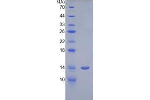 SDS-PAGE analysis of Human Cystatin 1 Protein.