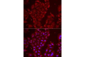 Immunofluorescence analysis of U2OS cell using TPP2 antibody.