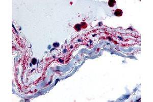 Immunohistochemical (Formalin/PFA-fixed paraffin-embedded sections) staining in human vascular smooth muscle with PTPMT1 polyclonal antibody . (PTPMT1 Antikörper)