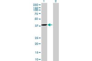 Western Blot analysis of DNTTIP1 expression in transfected 293T cell line by DNTTIP1 MaxPab polyclonal antibody. (DNTTIP1 Antikörper  (AA 1-329))