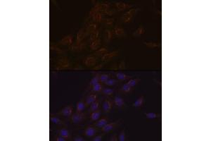 Immunofluorescence analysis of C6 cells using PIST/GOPC Rabbit mAb (ABIN1678809, ABIN1678808, ABIN7101325 and ABIN7101326) at dilution of 1:100 (40x lens). (GOPC Antikörper)