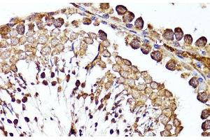 Immunohistochemistry of paraffin-embedded Rat testis using MME Polyclonal Antibody at dilution of 1:100 (40x lens). (MME Antikörper)