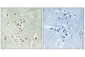 Immunohistochemistry analysis of paraffin-embedded human brain tissue using GADD45GIP1 antibody. (GADD45GIP1 Antikörper)