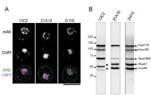 Immunohistochemistry (IHC) image for anti-Nucleoporin 98kDa (NUP98) (GLFG Motif), (N-Term) antibody (ABIN2452064) (NUP98 Antikörper  (GLFG Motif, N-Term))