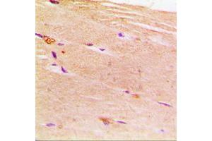 Immunohistochemical analysis of ACTN2 staining in human muscle formalin fixed paraffin embedded tissue section.