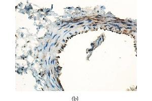 Immunohistochemistry (IHC) image for anti-Chemokine (C-C Motif) Ligand 2 (CCL2) (AA 61-148) antibody (ABIN737676)
